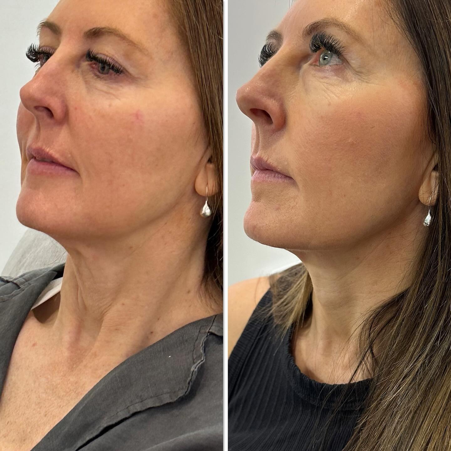 Client result 01