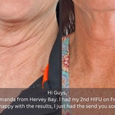 Client result 02