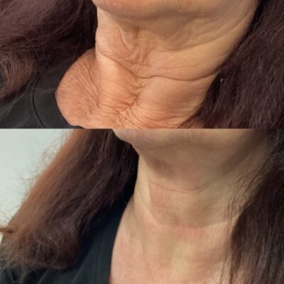 Client result 03