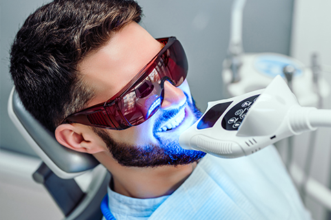 Professional Teeth Whitening with Boutique Whitening