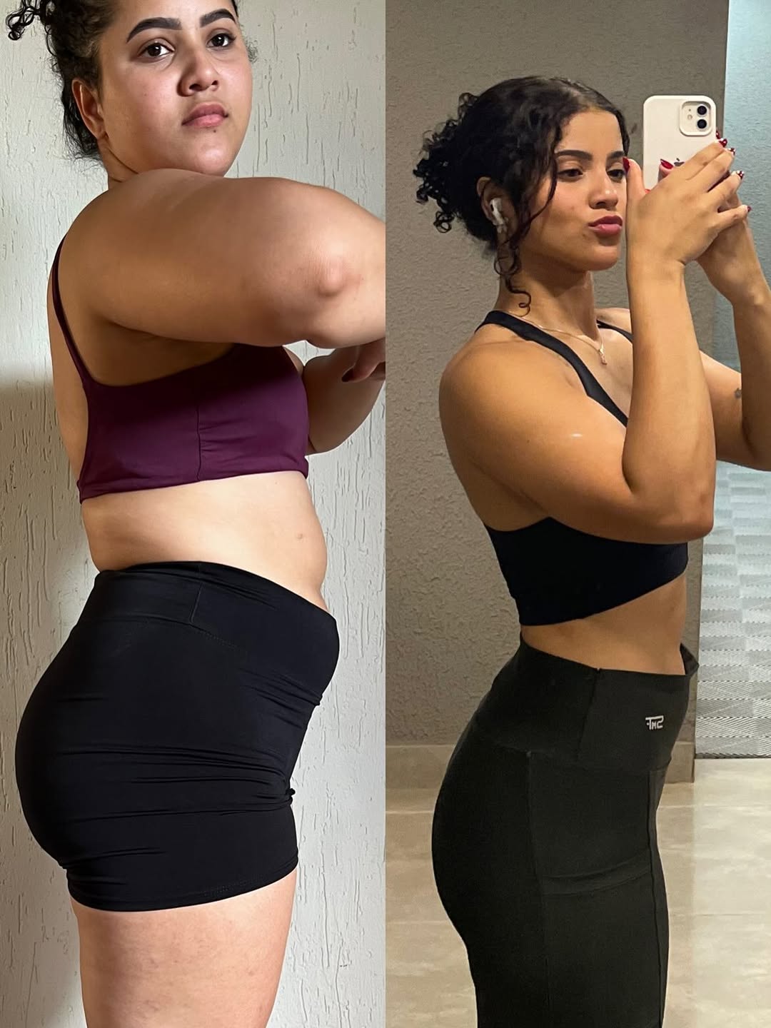 Antes e depois Tivolly