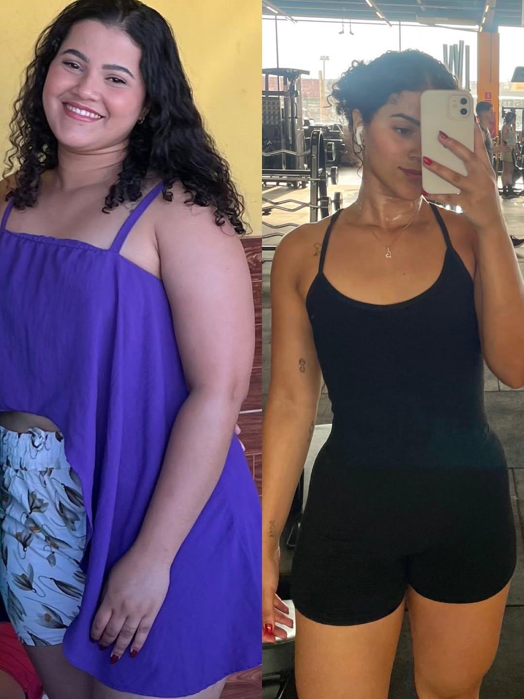 Antes e depois Tivolly