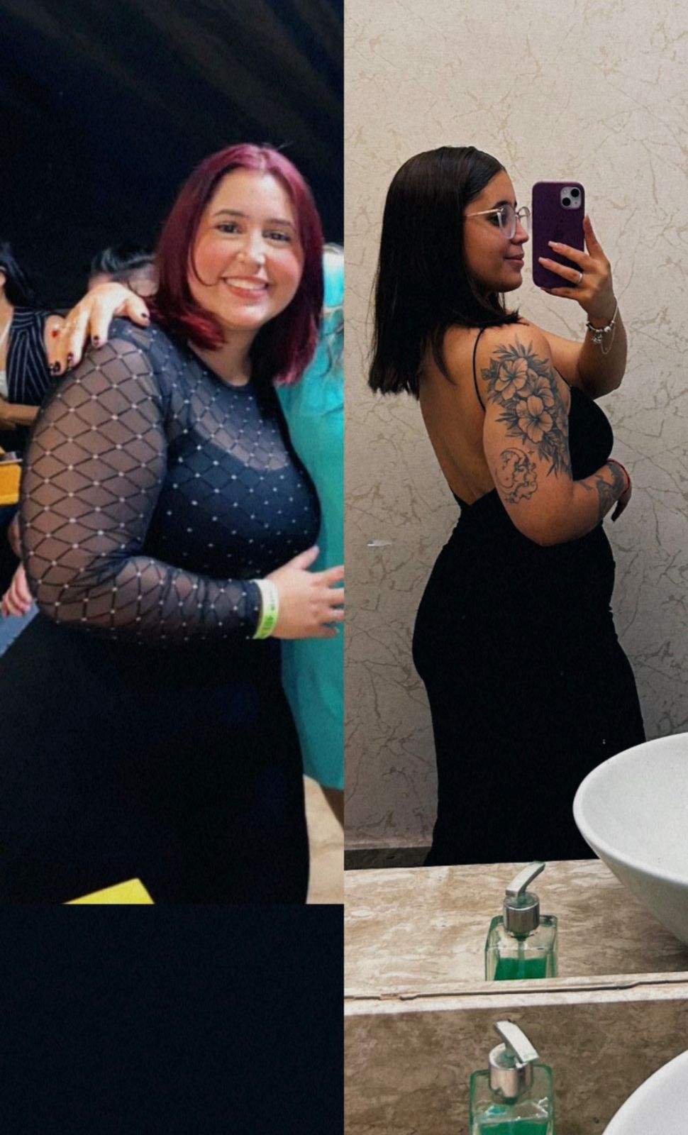 Antes e depois Tivolly