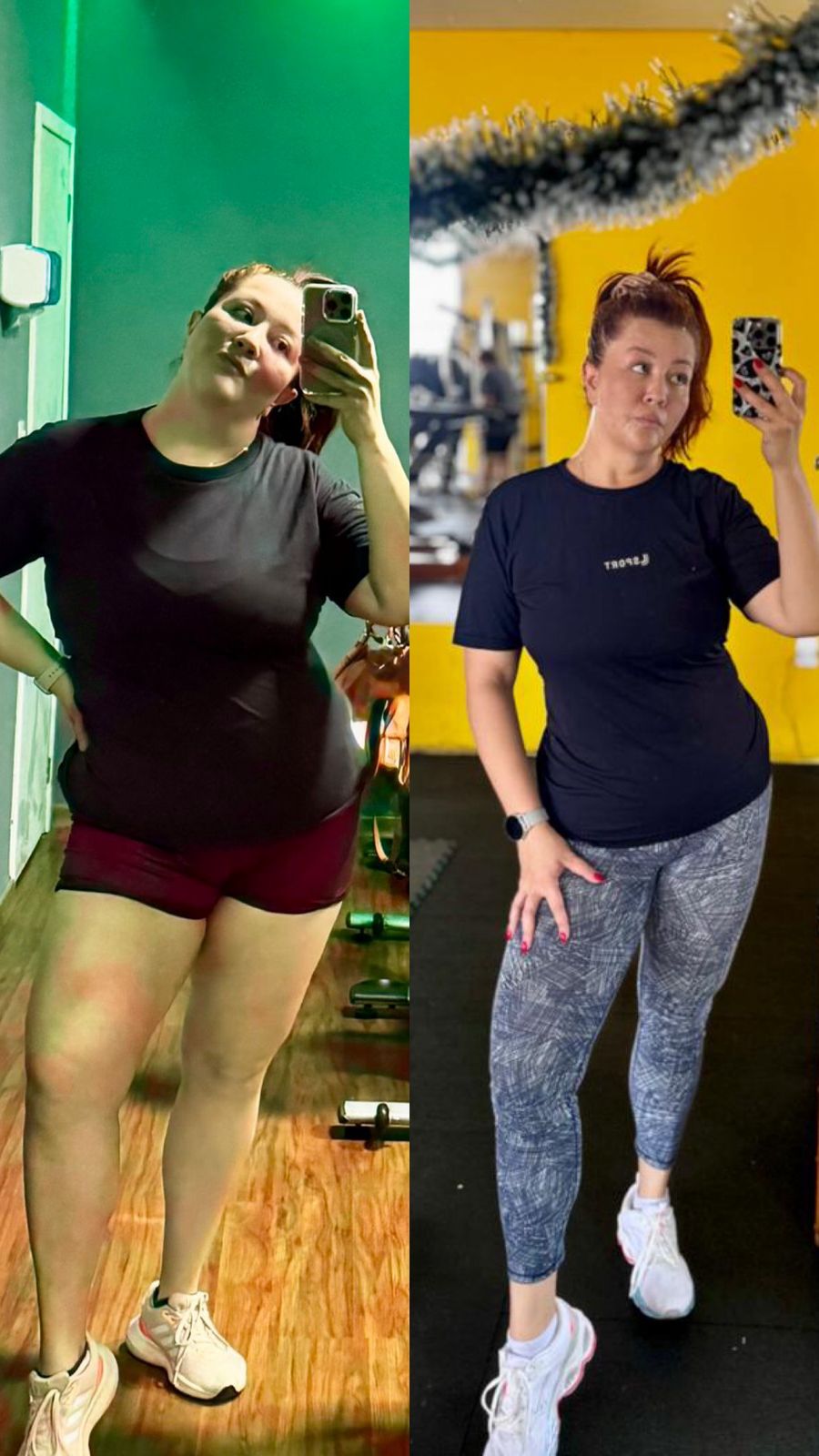Antes e depois Tivolly