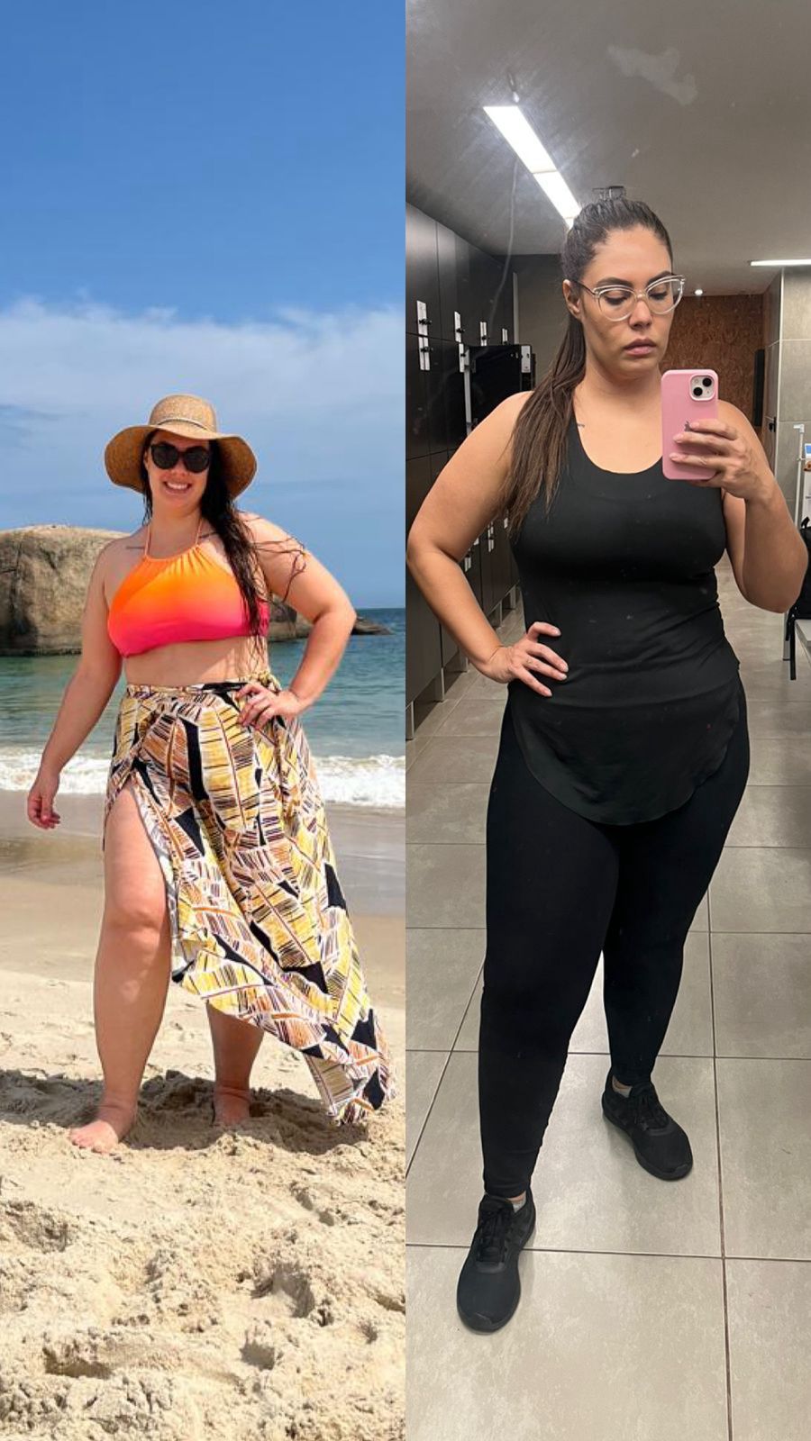 Antes e depois Tivolly