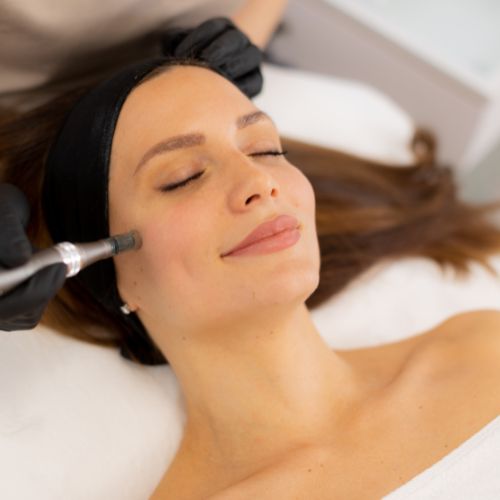 A microneedling tool used for PRP Microneedling treatments at Image Clinic in Windsor