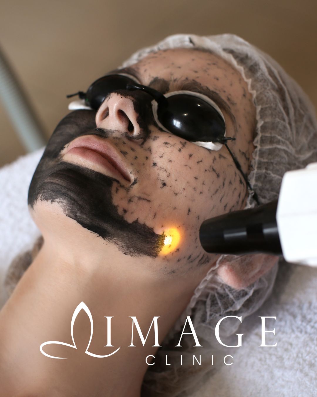 A client receiving a BelaméD Microdermabrasion treatment in Windsor
