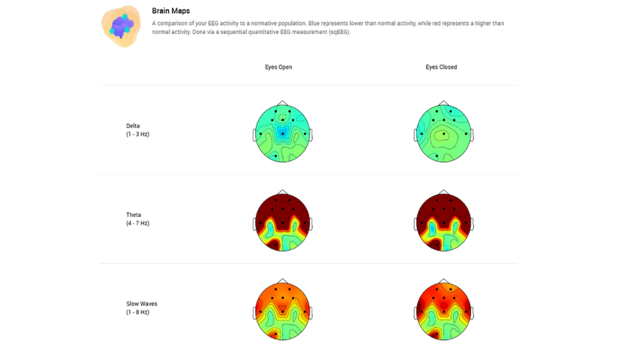 Clinical assessment representing brain mapping