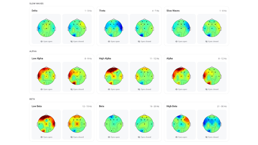 Clinical assessment representing brain mapping