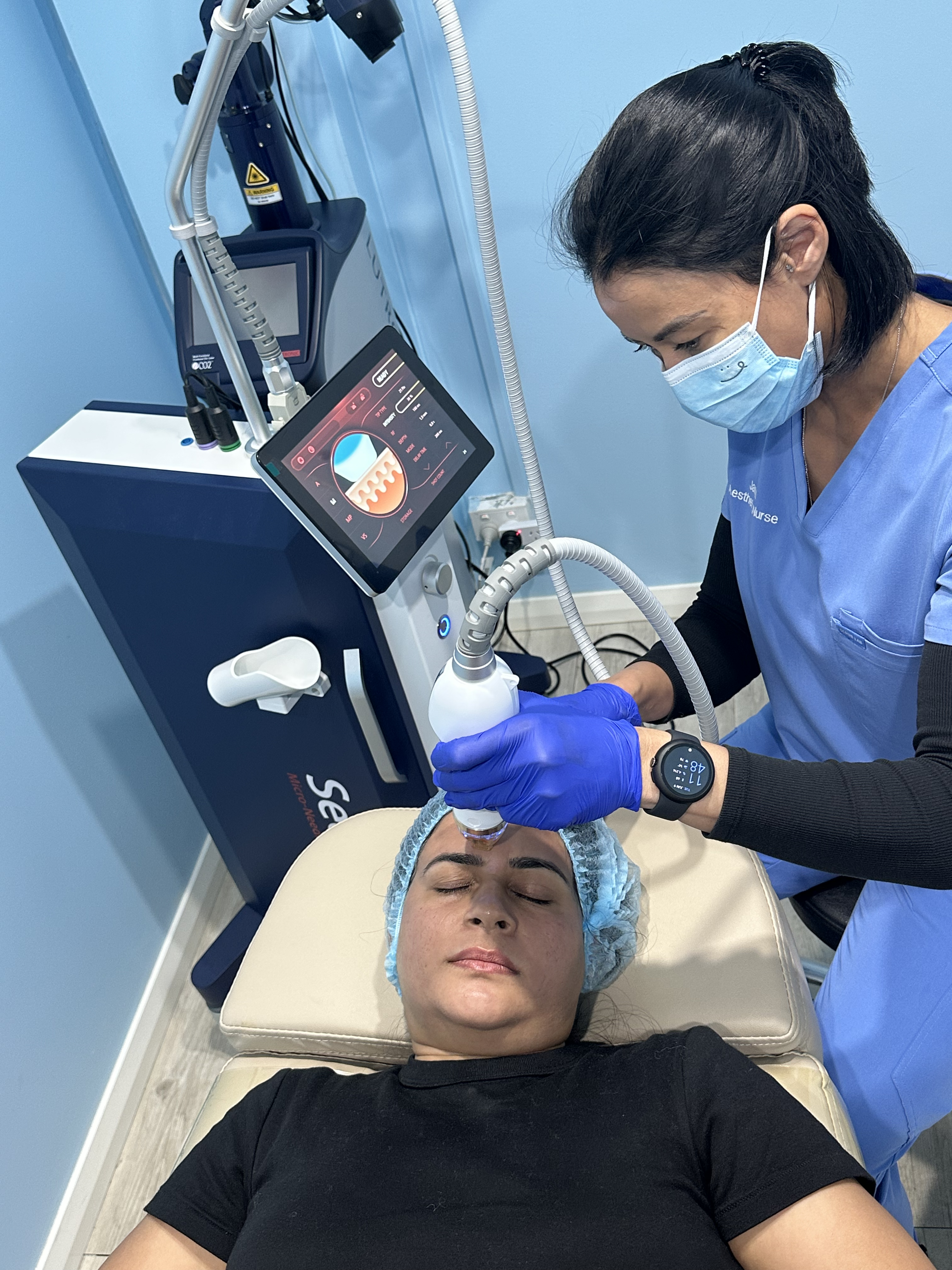 How Secret RF microneedling works