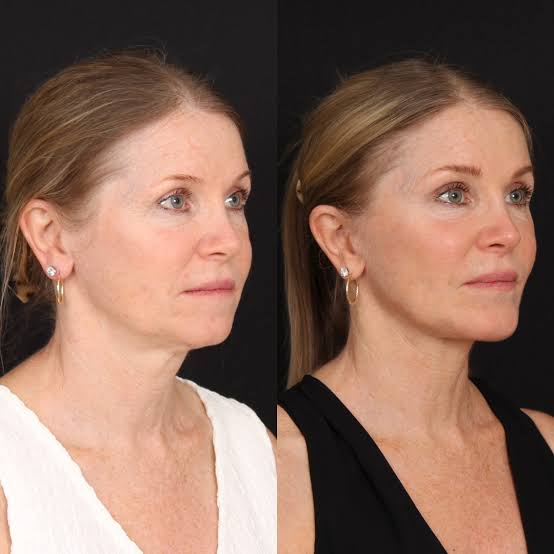 Client result example