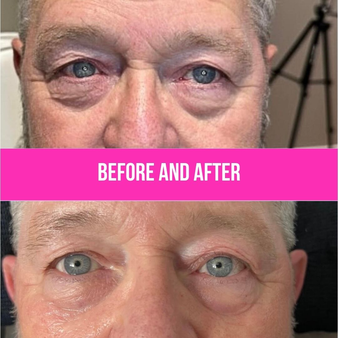 Natural Tixel results - refreshed, not different