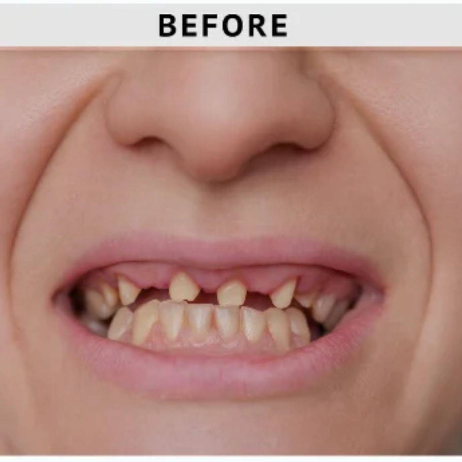 Before dental treatment