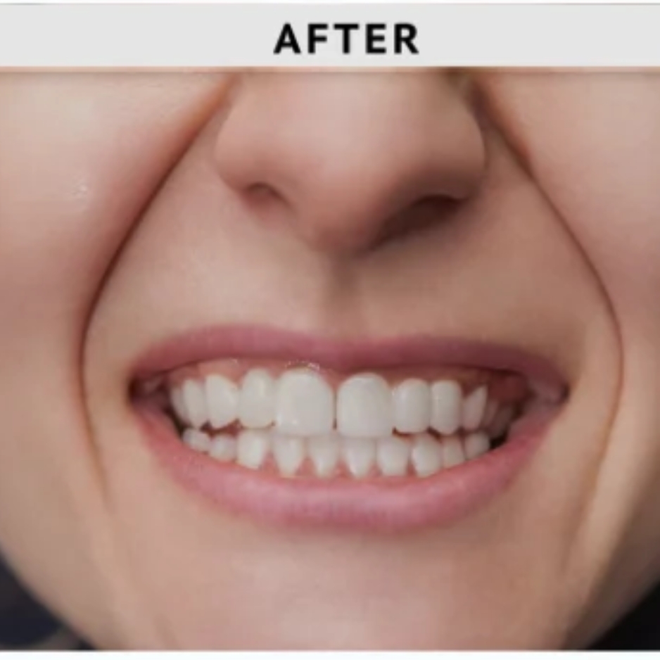 After dental treatment