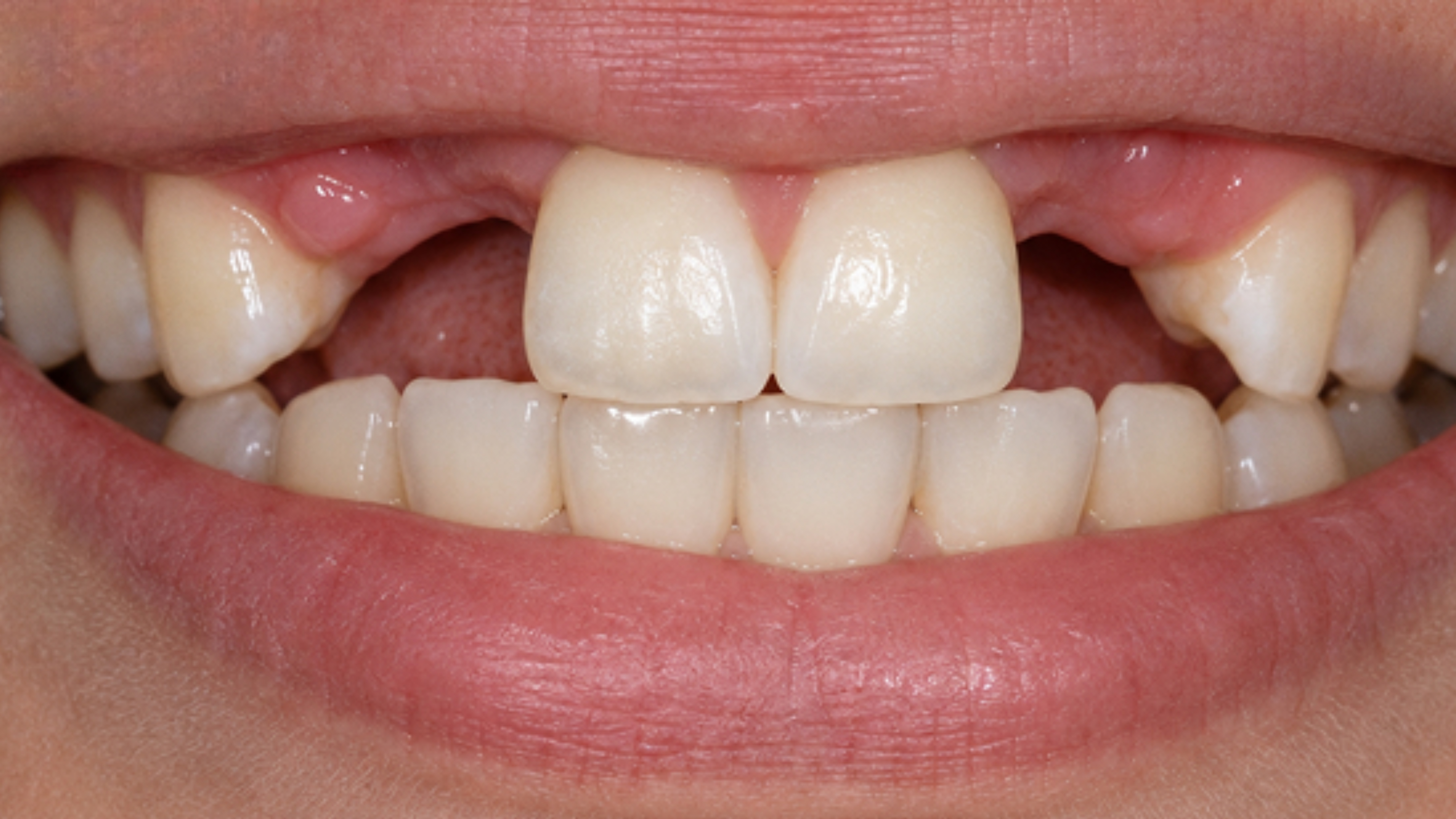 Before dental treatment