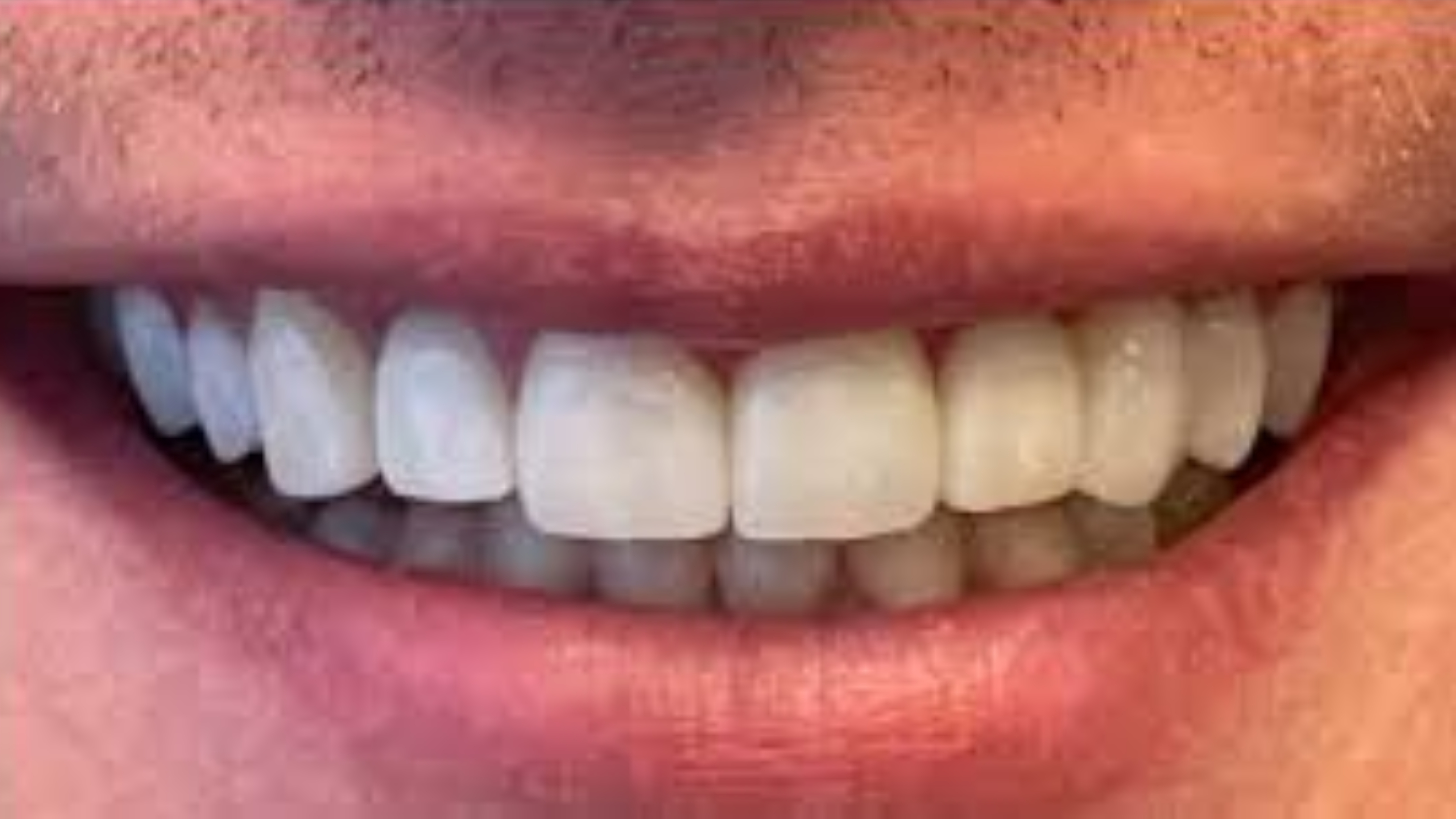 After dental treatment