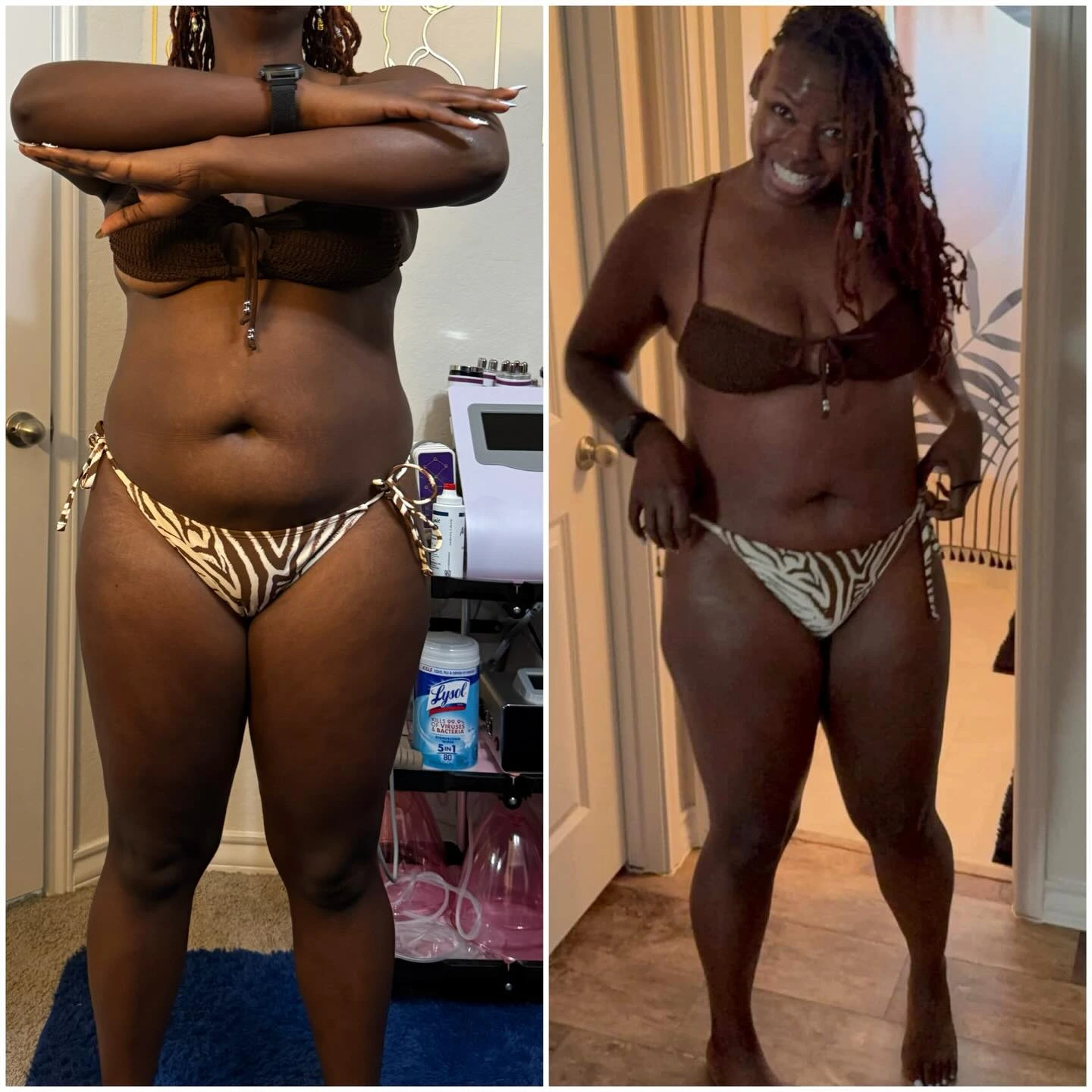 Non-invasive body contouring