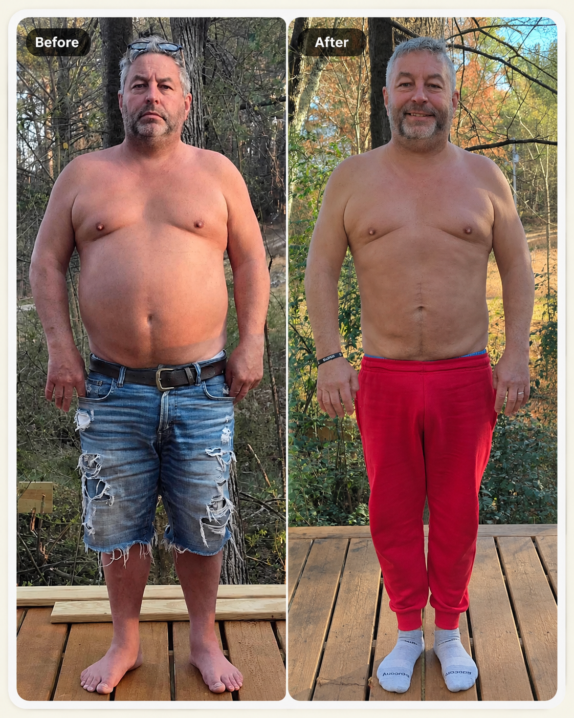 Brett before and after result