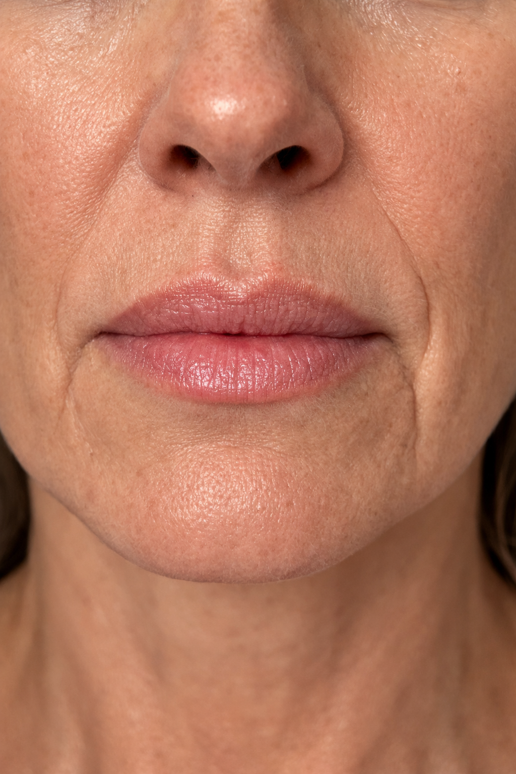 Will Botox Help Marionette Lines? What St. Pete Patients Need to Know