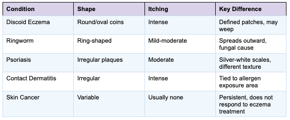 Early Stage Discoid Eczema: What It Looks Like and What to Do Next
