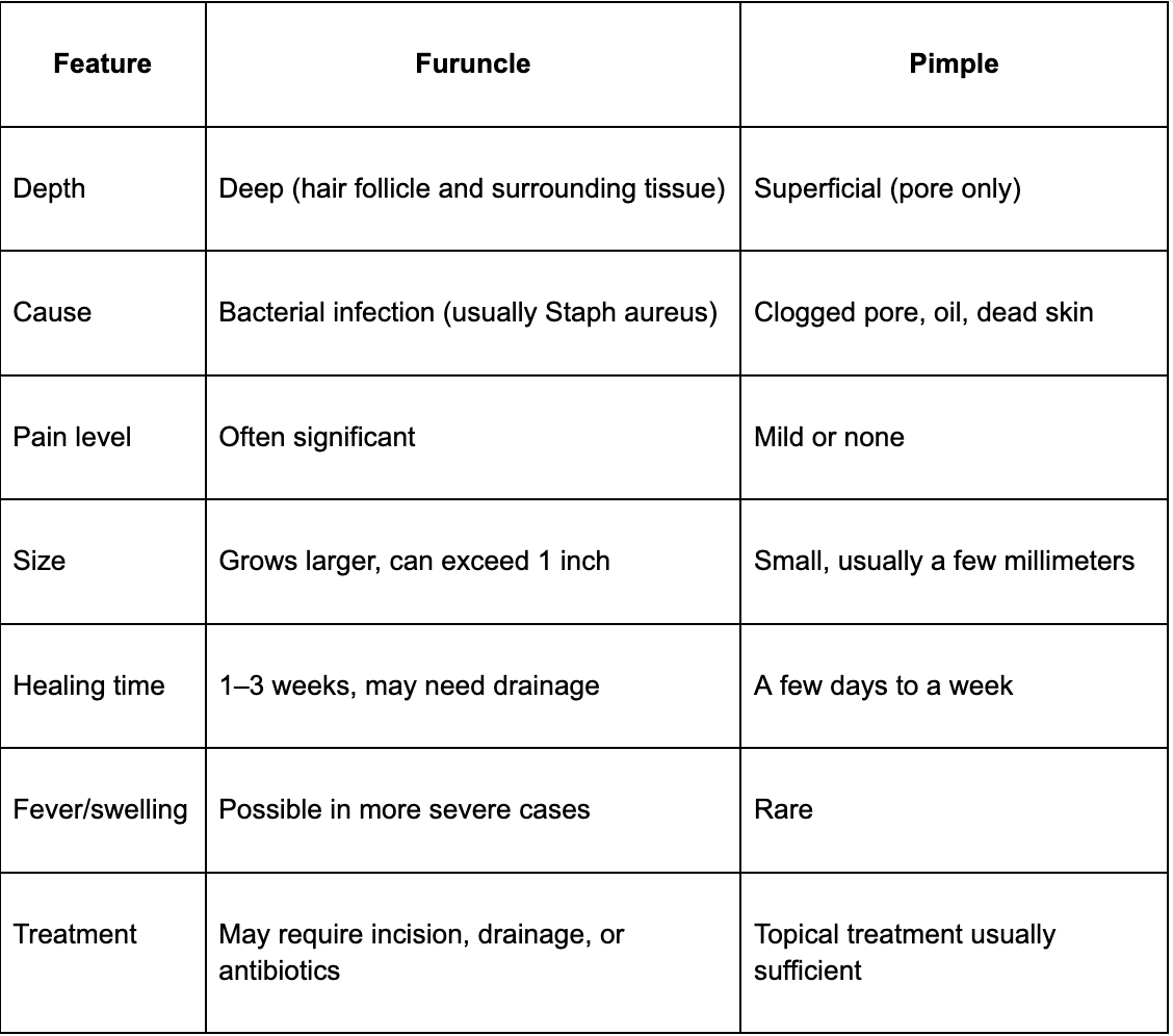 Furuncle vs. Pimple: How to Tell the Difference