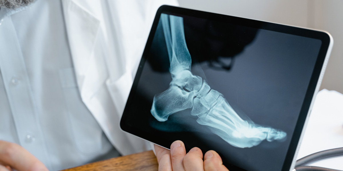 Doctor holding a tablet showing a foot and ankle X-ray Doctor holding a tablet showing a foot and ankle X-ray