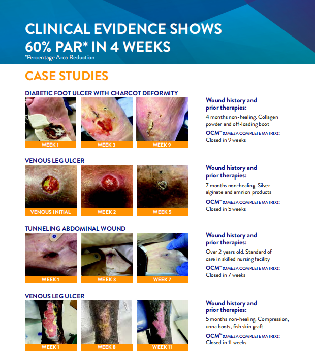 Omeza OCM Clinical Evidence Data