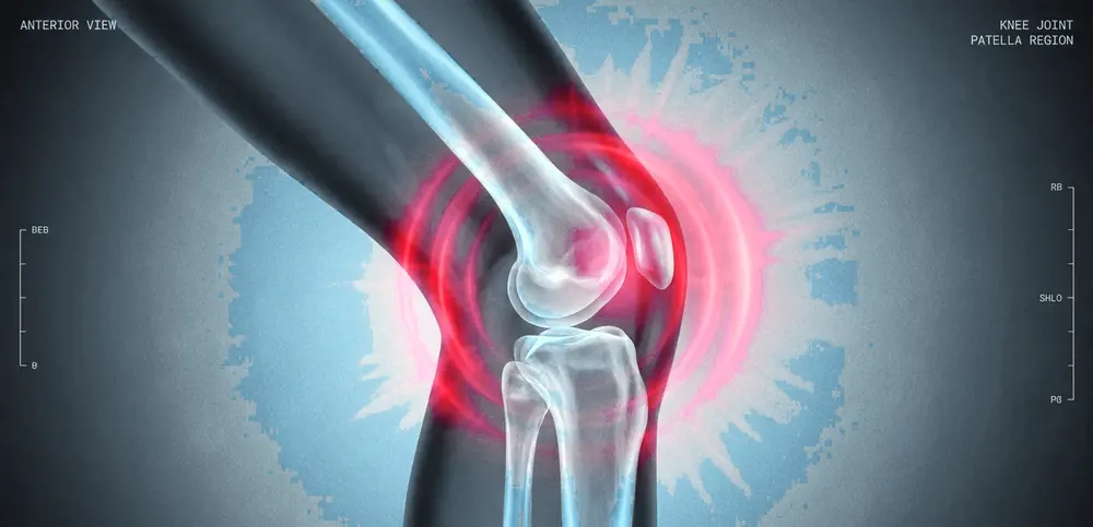 PRP therapy for knee joint pain and regeneration