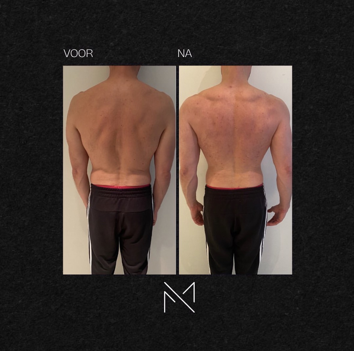 Voor en na — MESFI klant