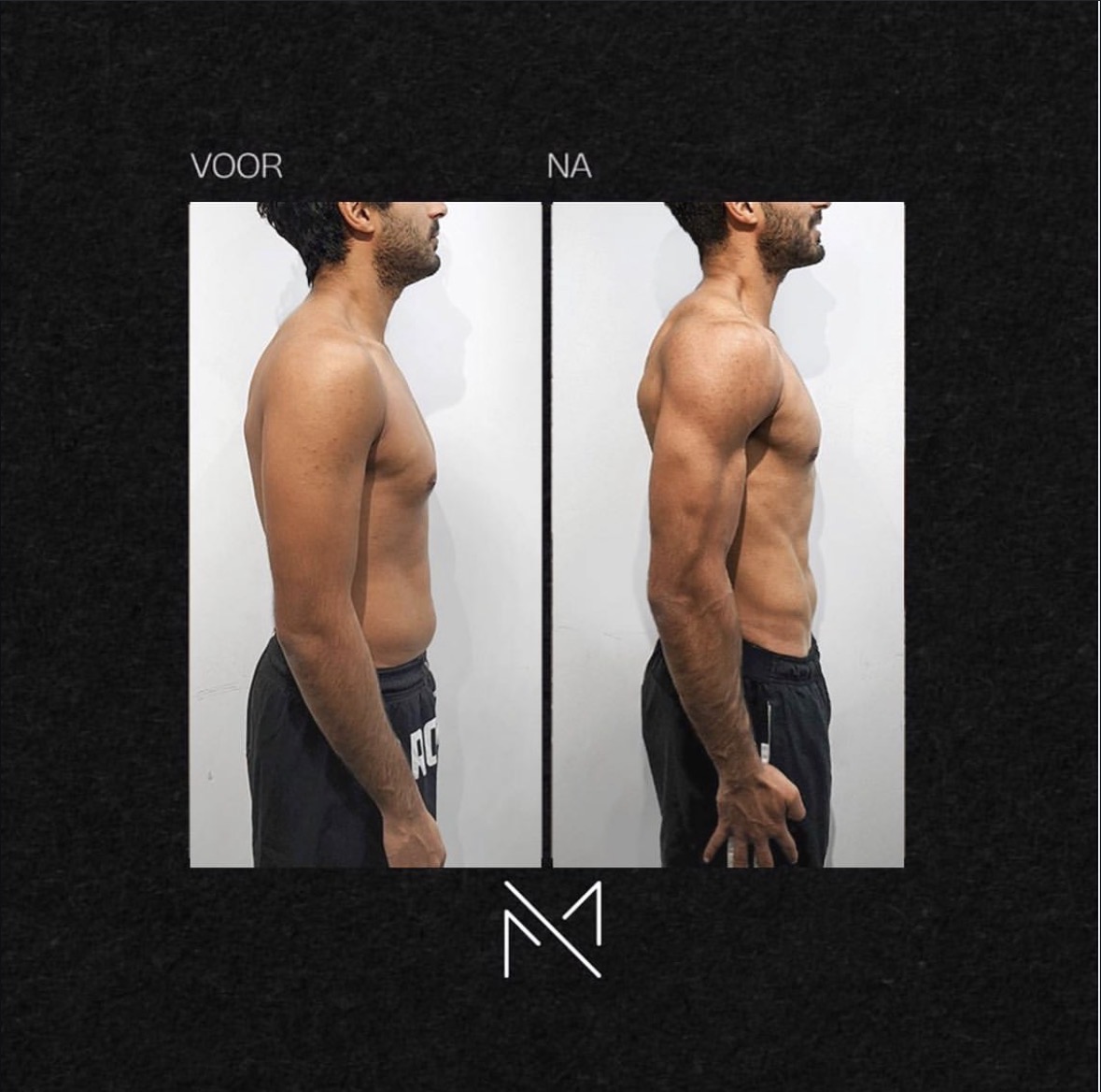 Vinni — voor en na