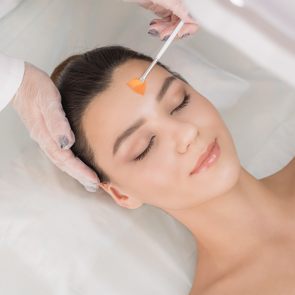 Chemical Peels