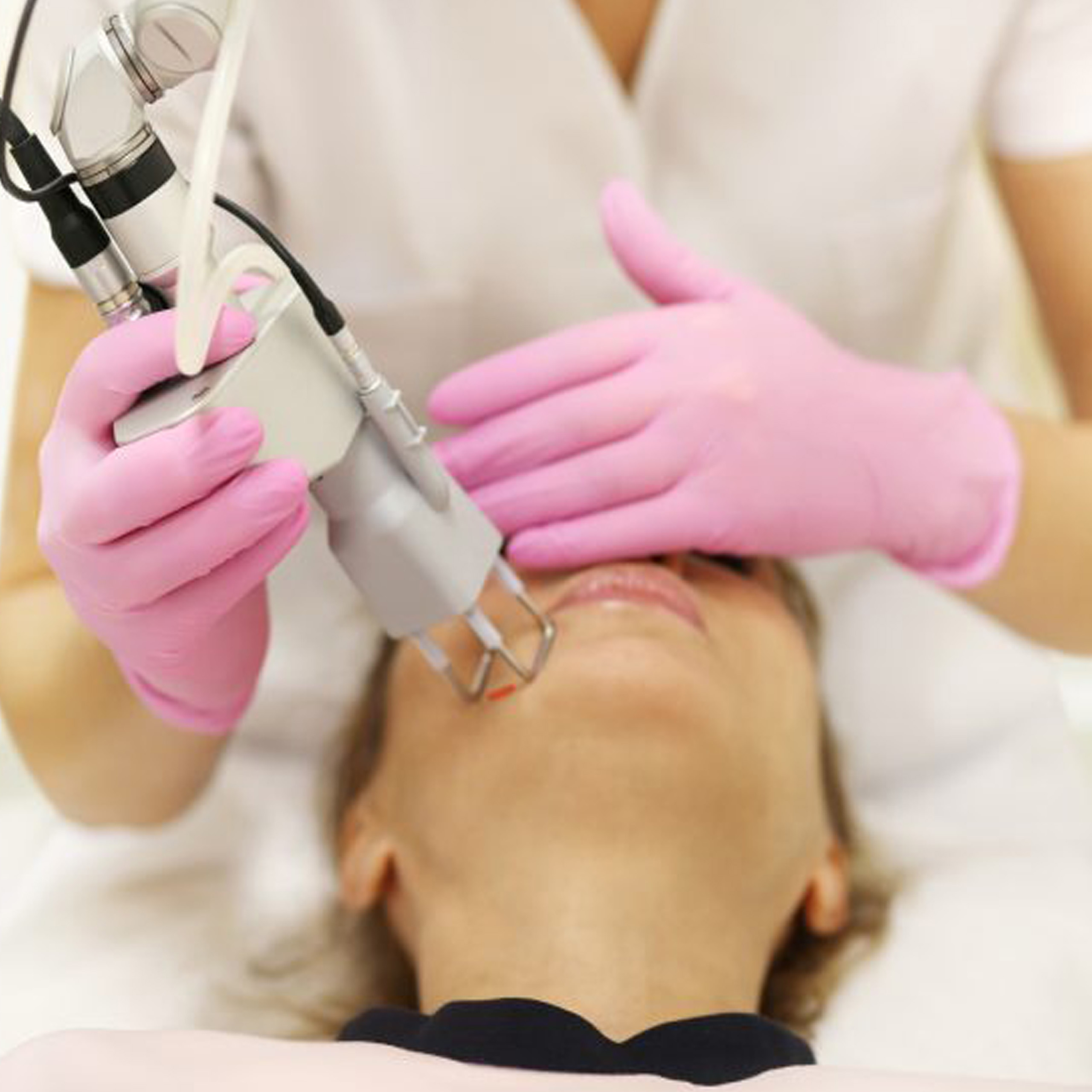 Helix CO2 Laser Resurfacing at SkinOvation