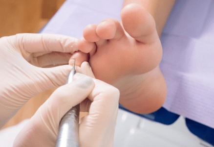 Ackworth Wellness Cenre PodiatrService 