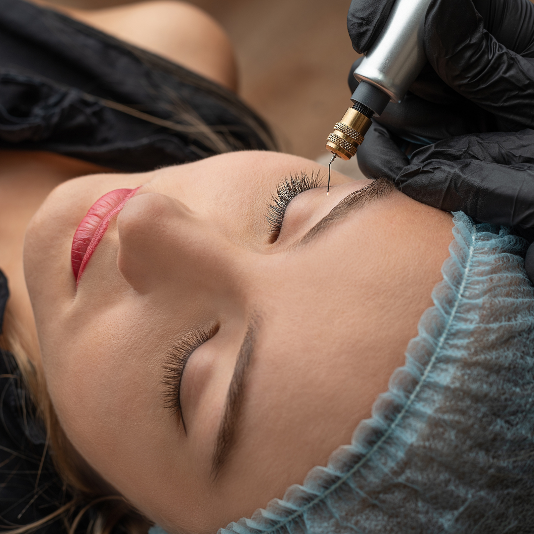 Radio Frequency Treatment Result