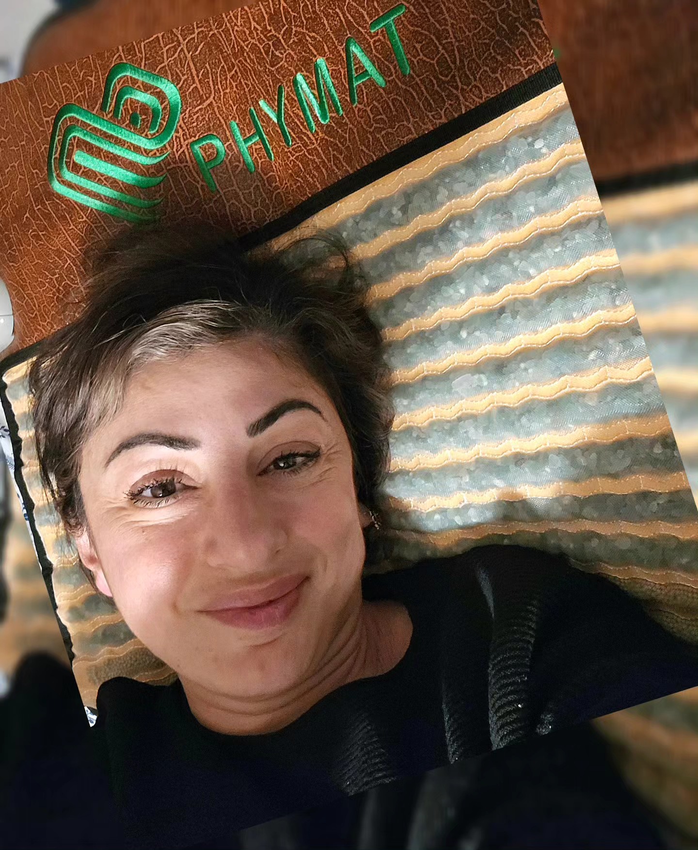 Radio Frequency Treatment Result