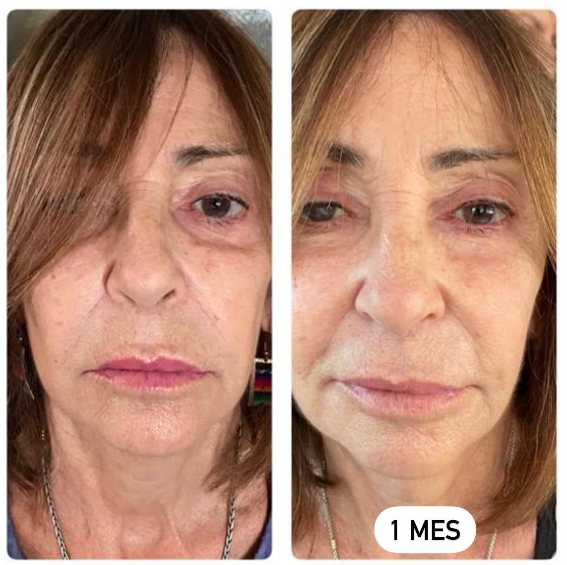 Testimonio antes y después