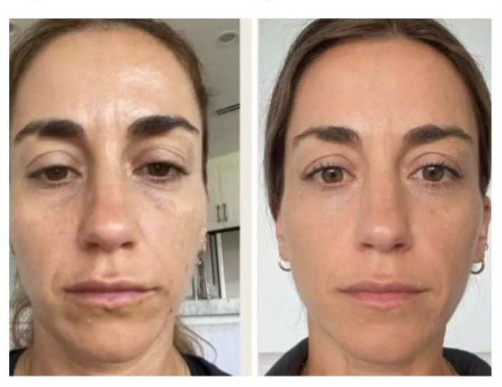Testimonio antes y después