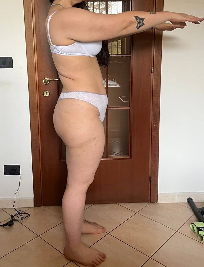 Laura Dopo