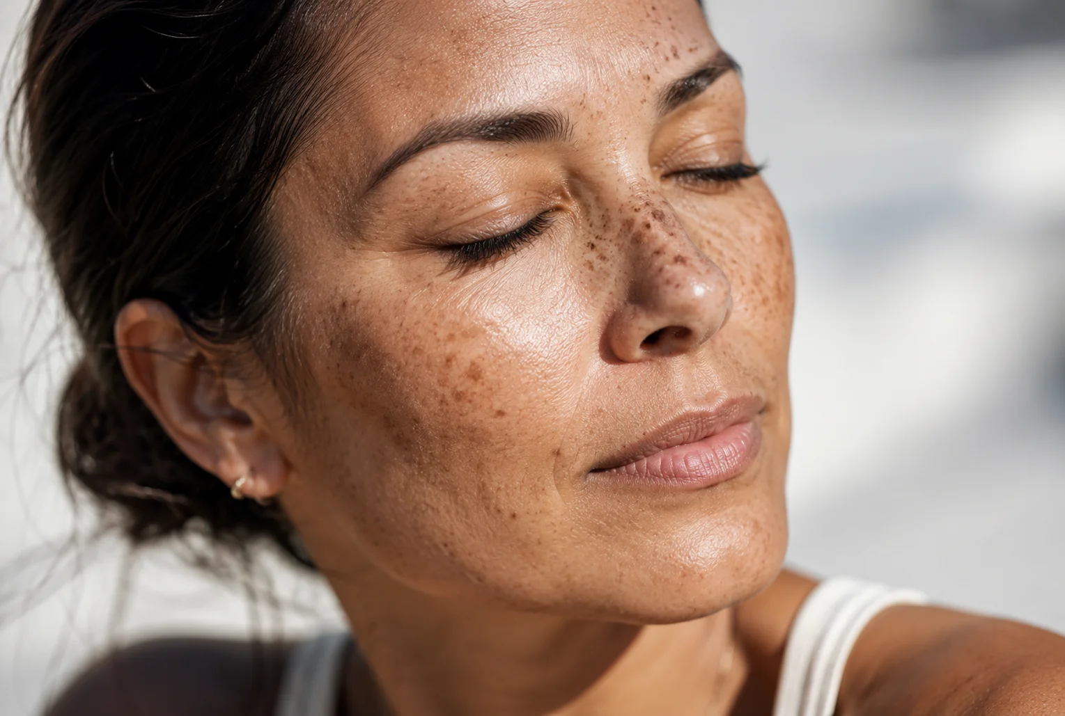Sun Damage