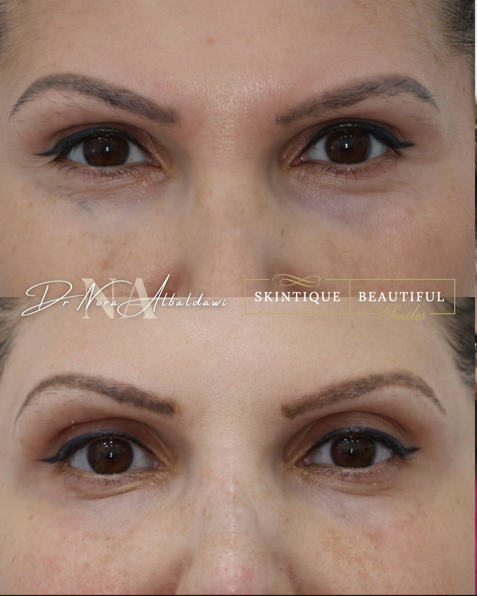 Transformation 2