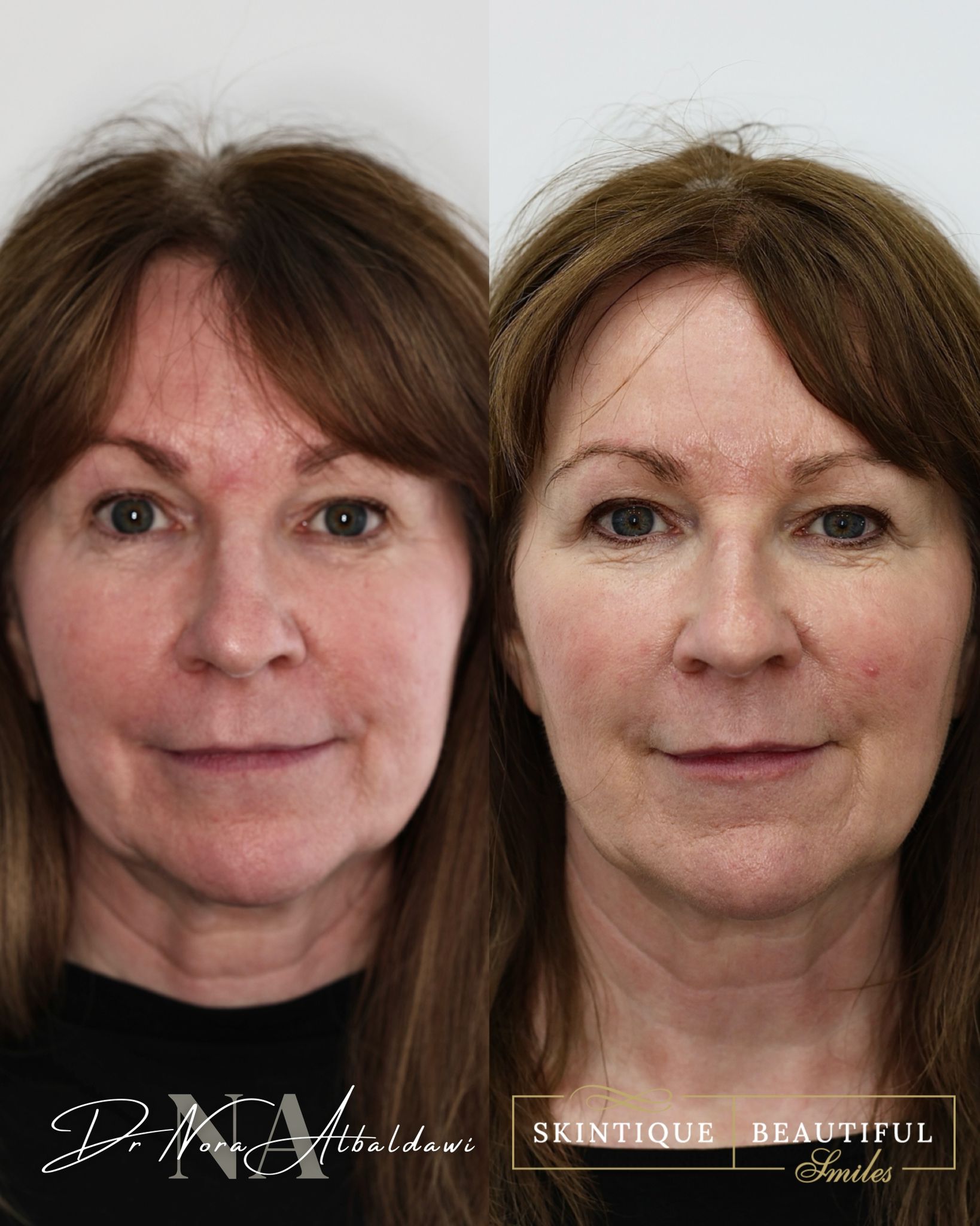 Patient transformation result