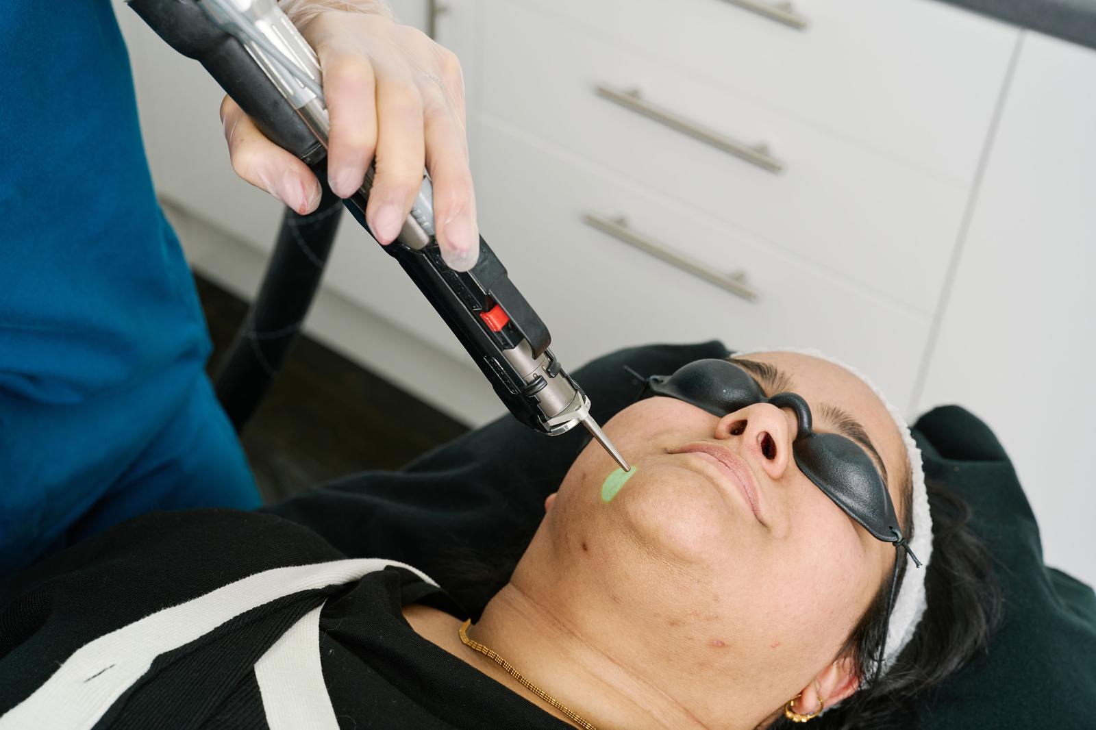 How to prepare for laser hair removal
