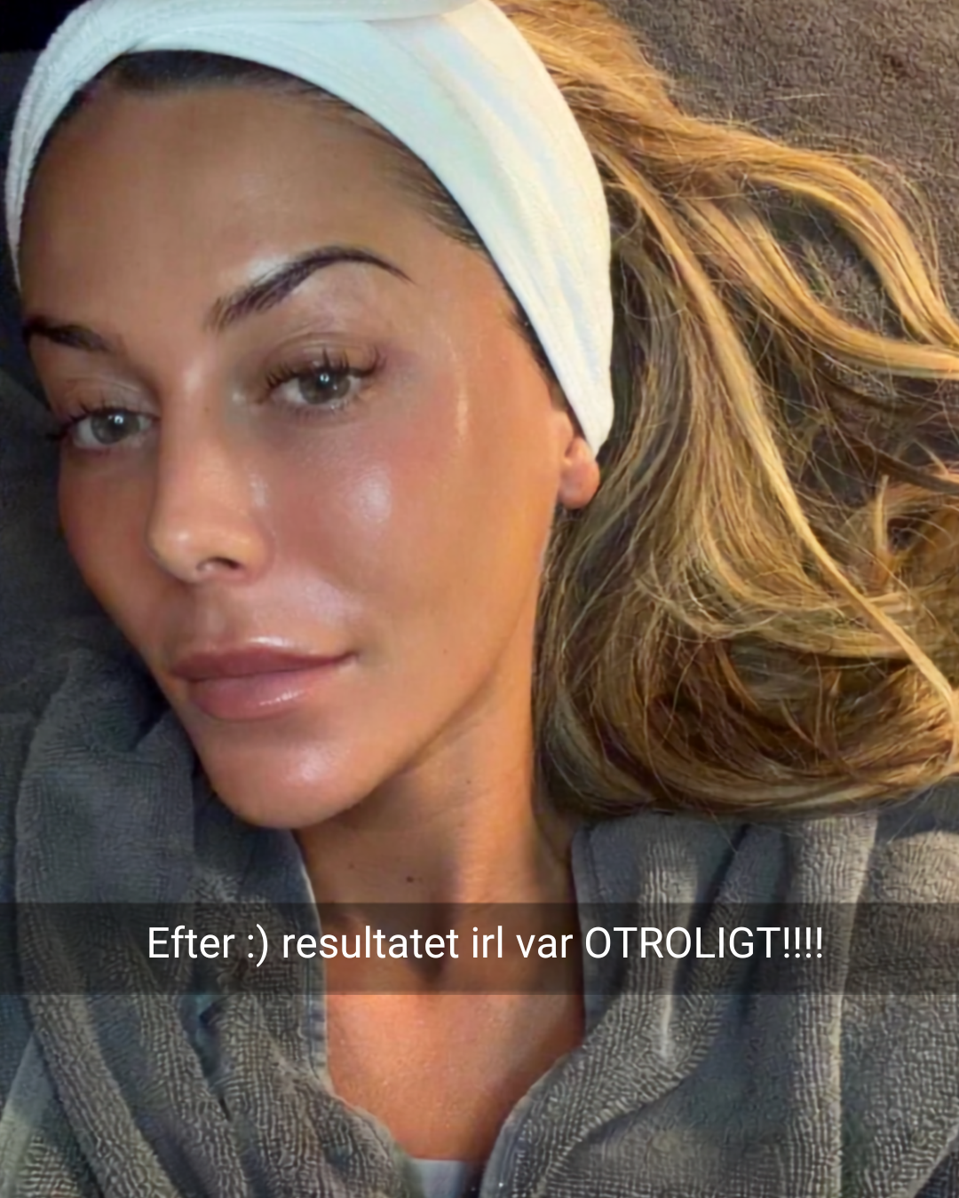Bianca Ingrosso etter Infuzion-behandling
