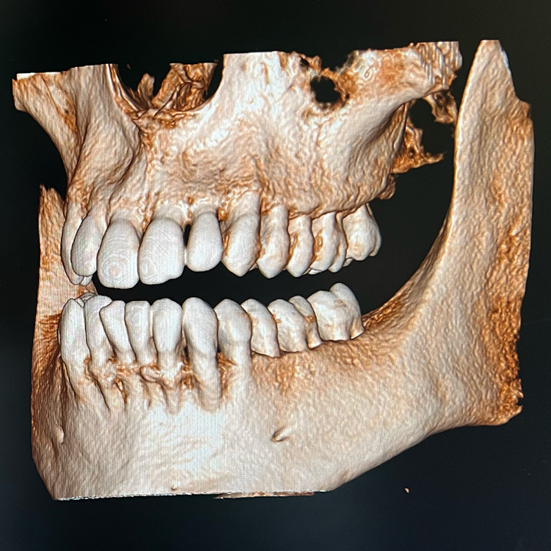 Photograph of a 3D printed model of a human skull with the lower jaw exposed, displaying a full set of teeth, used to demonstrate various specialty dental services.