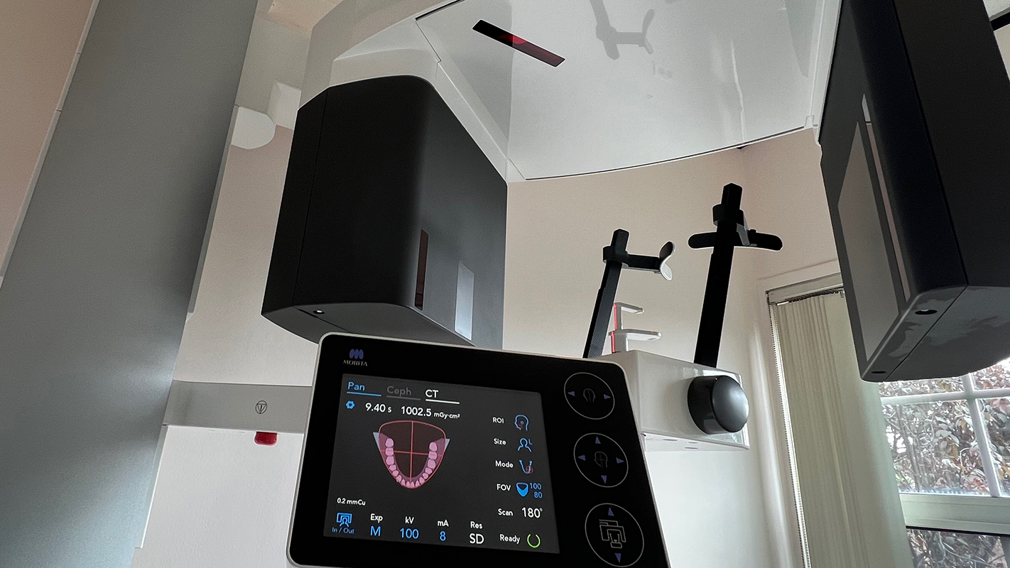 Close up of CBCT machine showing display screen