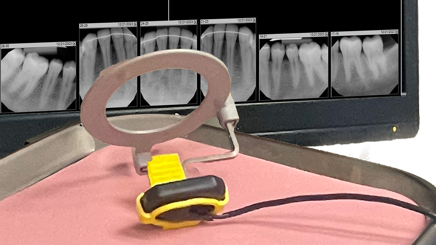 Dental digital X-ray sensor in the foreground in its sensor holder sitting on a tray with pink tray liner. In  the background is a computer screen showing digital X-rays. 