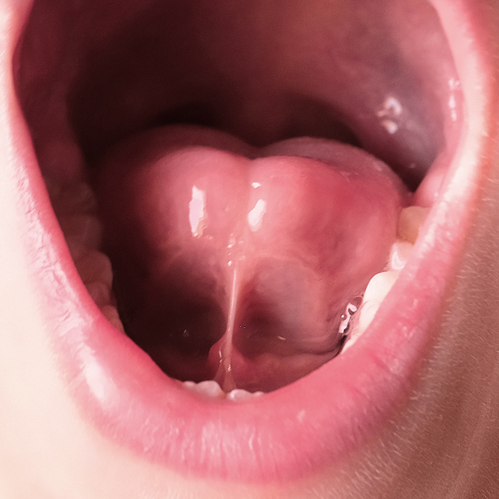 Mouth open with a tongue tie 