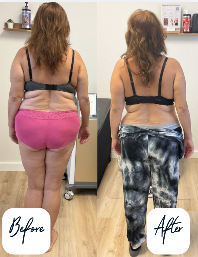 Semaglutide Weight Loss Honolulu Semaglutide Weight Loss Honolulu