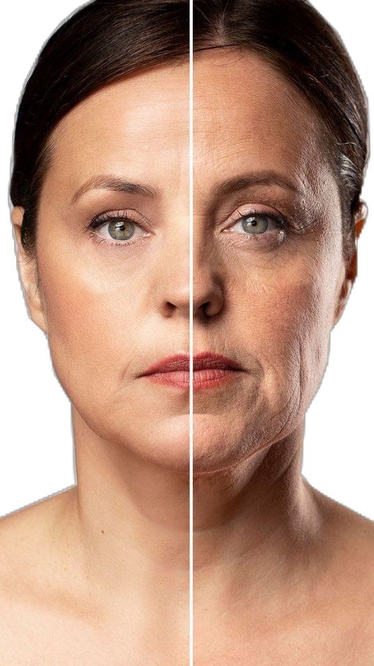 Bioestimulación en Clínica Munara