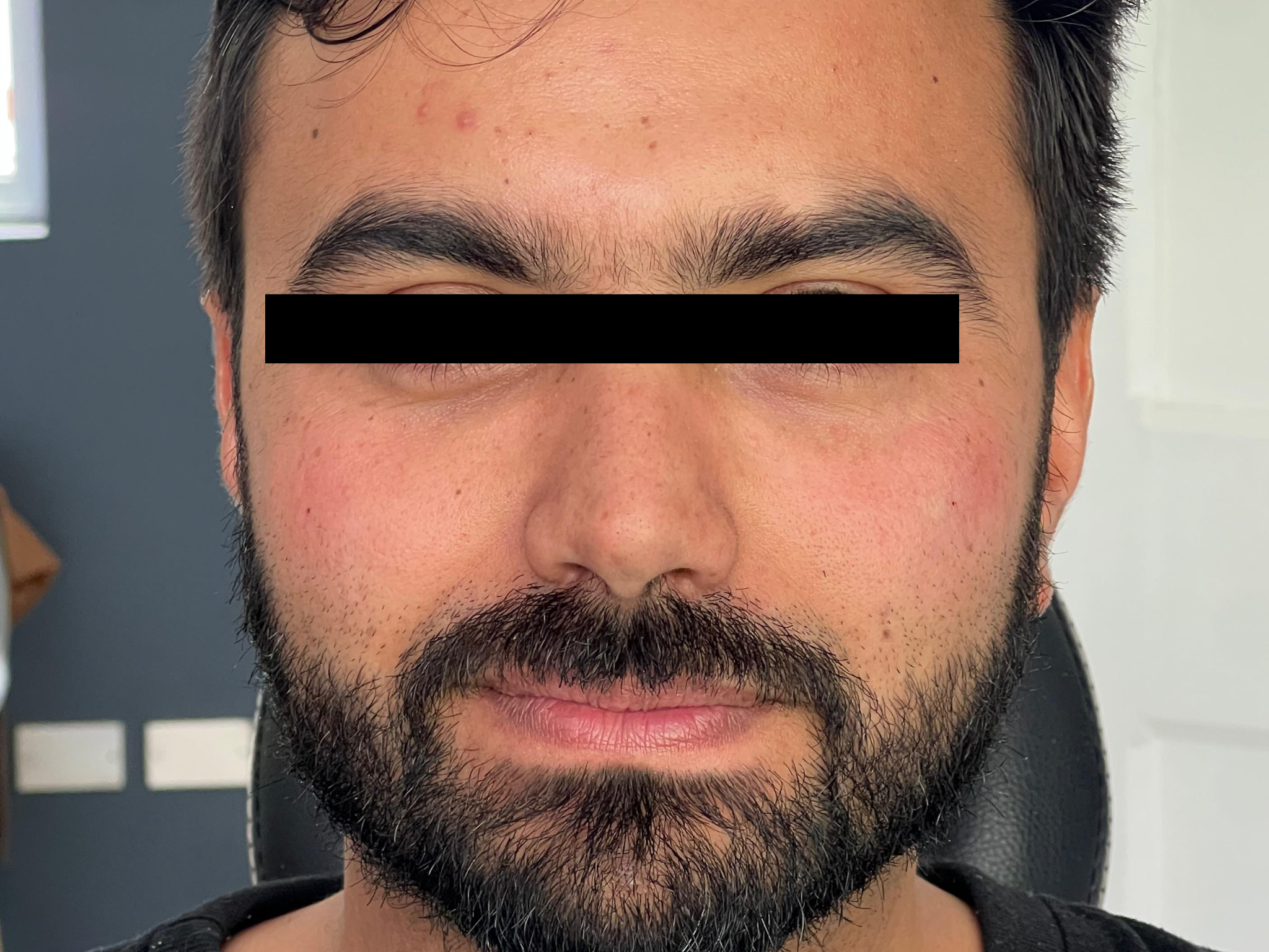 Antes
